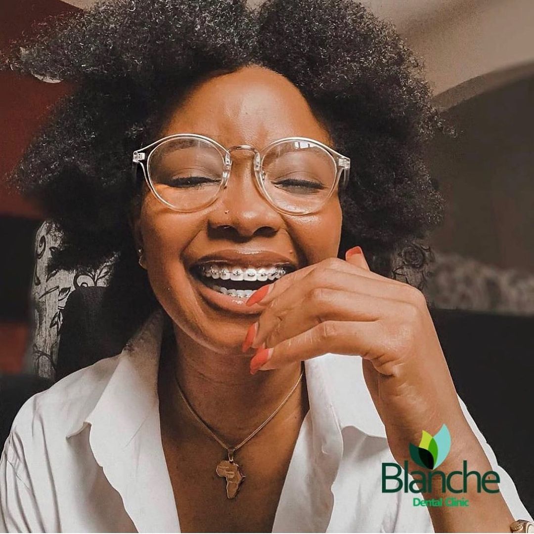 Best Dental Clinic For All Types Of Braces