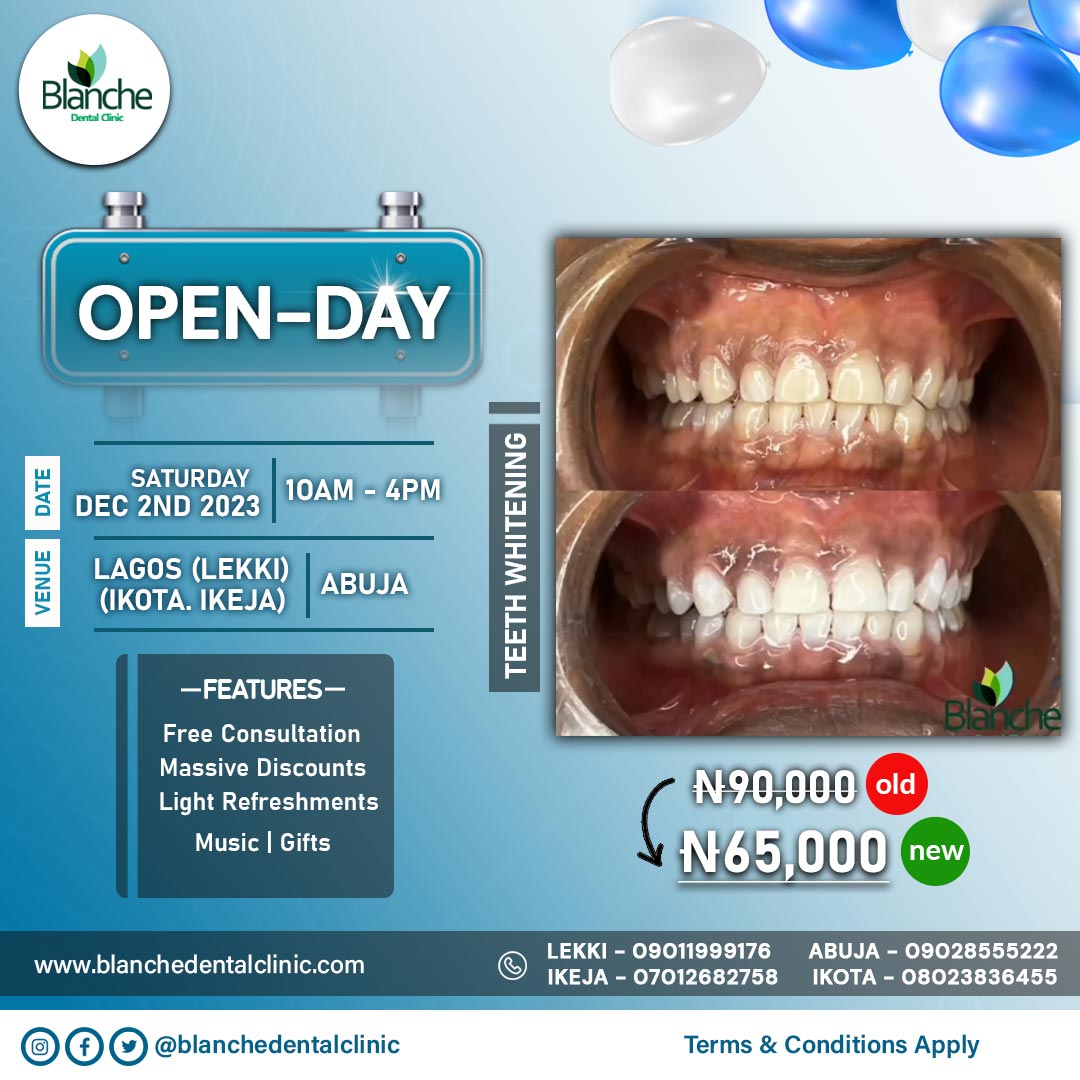Blanche Dental Clinic Open Day flyer