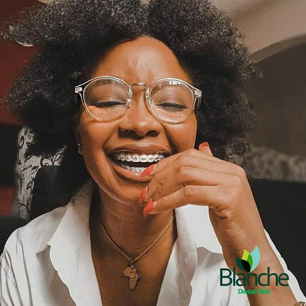 A lady happily wears a smile after fixing her Braces at Blanche Dental Clinic